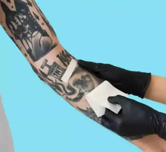 Saniderm Transparent Adhesive Bandage Aftercare