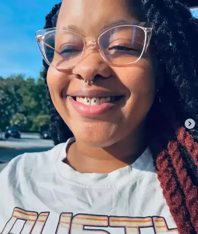 Fresh Septum piercing placed symmetrical to a healed smiley piercing both using titanium internally threaded circular barbells done by Amber Paje of James River Tattoo in Carrollton Virginia