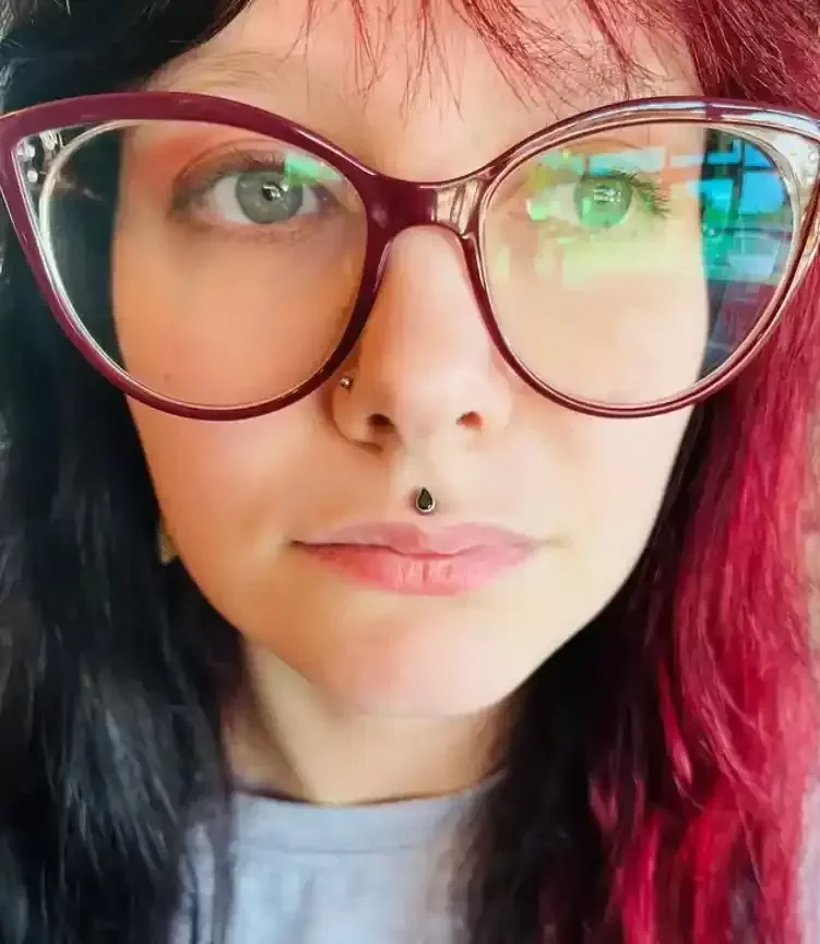 Healed Medusa Piercing with titanium pear shape black cubic zirconia on titanium labret post done by Amber Paje of James River Tattoo in Carrollton Virginia