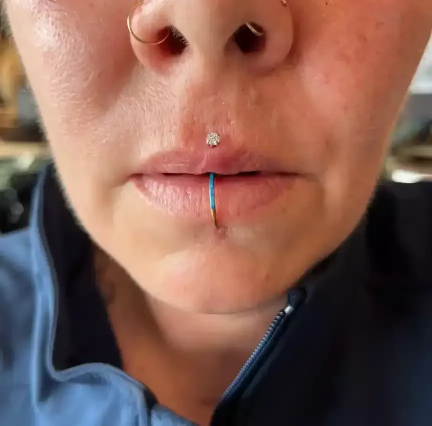New Medusa piercing using titanium cubic zirconium threadless end and titanium threadless labret post done by Amber Paje of James River Tattoo in Carrollton Virginia